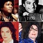 Image result for Michael Jackson Before and After Fire