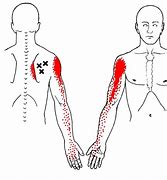 Image result for Rotator Cuff Trigger Points