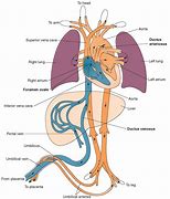 Image result for Neonatal Circulation