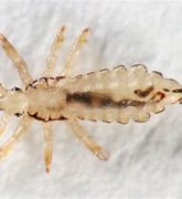 Image result for Body Lice On Humans