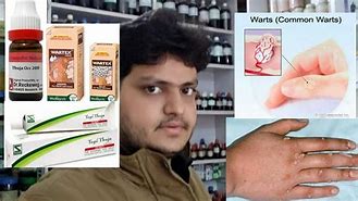 Image result for Wart Removal Cream