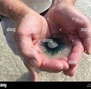 Image result for Blue Button Jellyfish Sting