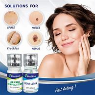 Image result for Home Remedy Skin Tag Remover