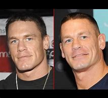 Image result for John Cena Surgery