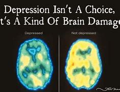 Image result for Depression Brain Meme