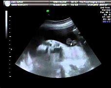 Image result for How Big Is a 28 Week Baby