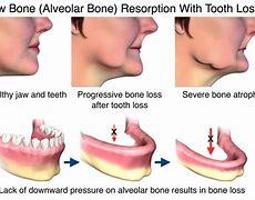 Image result for Jawbone Medical