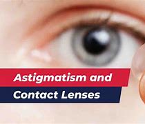 Image result for Contact Lens for Myopia and Astigmatism