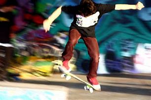 Image result for Skateboard Injuries