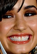 Image result for Demi Lovato Teeth