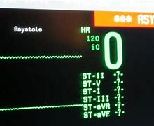 Image result for Hospital Monitor Sounds