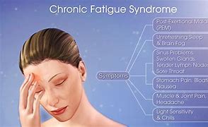 Image result for Chronic Fatigue