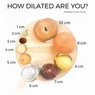 Image result for How Dilated AM I