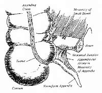 vermiform appendix 的图像结果