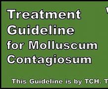 Image result for Molluscum Contagiosum On Eyelid