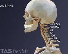 Image result for C5 Cervical Spine