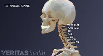 Image result for C4 Spine