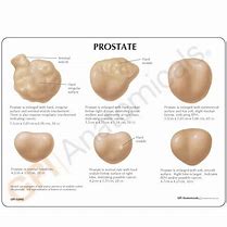 Image result for 7 Cubic Inch Prostate