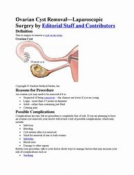 Image result for Ovarian Cyst Removal