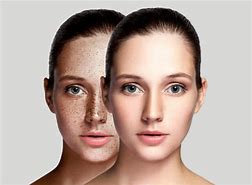 Image result for Human Skin Pigmentation