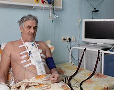 Image result for Recovery After Open Heart Surgery