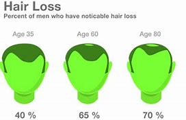 Image result for Hair Loss Teenager