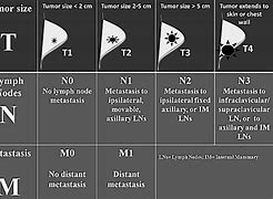 Image result for Cancer Tumor Sizes