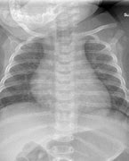 Image result for 9 Week Old Chest