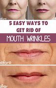 Image result for Deep Wrinkles around Mouth