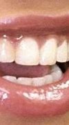 Image result for Beyonce's Teeth