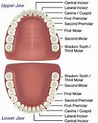 Image result for Lower Jaw Teeth