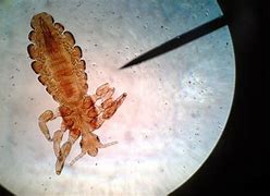Image result for Anoplura