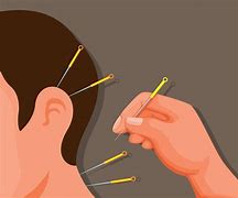 Image result for Acupuncture Cartoon
