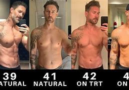 Image result for TRT Before and After