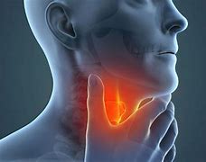 Image result for Head and Neck Cancer