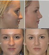 Image result for Different Nose Shapes
