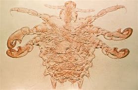 Image result for Crabs STD Pics