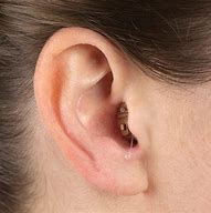 Image result for Invisible in Canal Hearing Aids