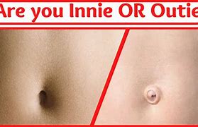 Image result for Normal Belly Button