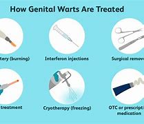 Image result for Removing Genital Warts