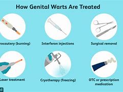 Image result for genital warts treatments