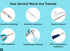 Image result for Genital Warts