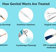Image result for Genital Wart Removal