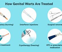 Image result for NIH Genital Warts
