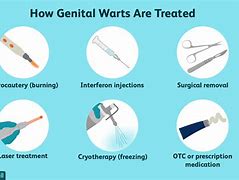 Image result for What Do Genital Warts Look Like