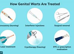 Image result for HPV Genital Warts Treatment