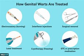 Image result for Genital Warts Treatment