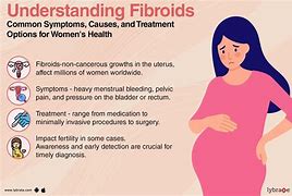 Image result for Fibroids and Pregnancy