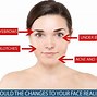 Image result for Autoimmune Disease Rash On Face
