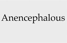 Image result for Anencephalous